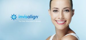 With clear aligners, your teeth can be aligned using a series of clear, custom, and removable aligners.With clear aligners, your teeth can be aligned using a series of clear, custom, and removable aligners.